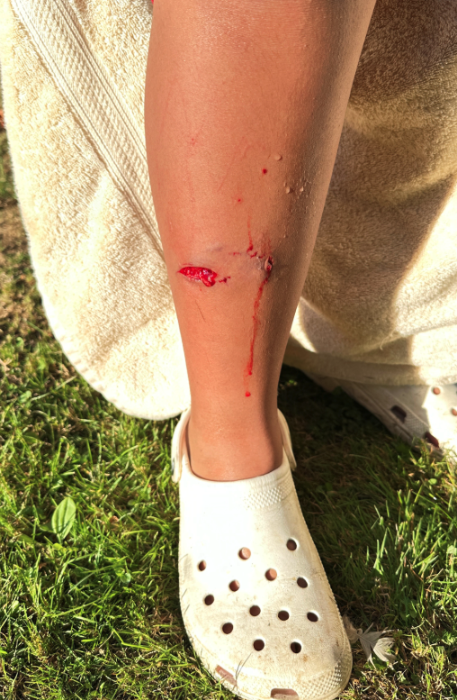<who> Photo credit: Len Watts </who> Taiaha Watts, 10, shows his river otter bite that required six to eight stitches.